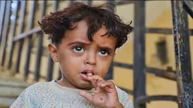 ​ساق مبتورة ومشهد قتل لن يُنسى.. مأساة طفل يمني مع ألغام الحوثي